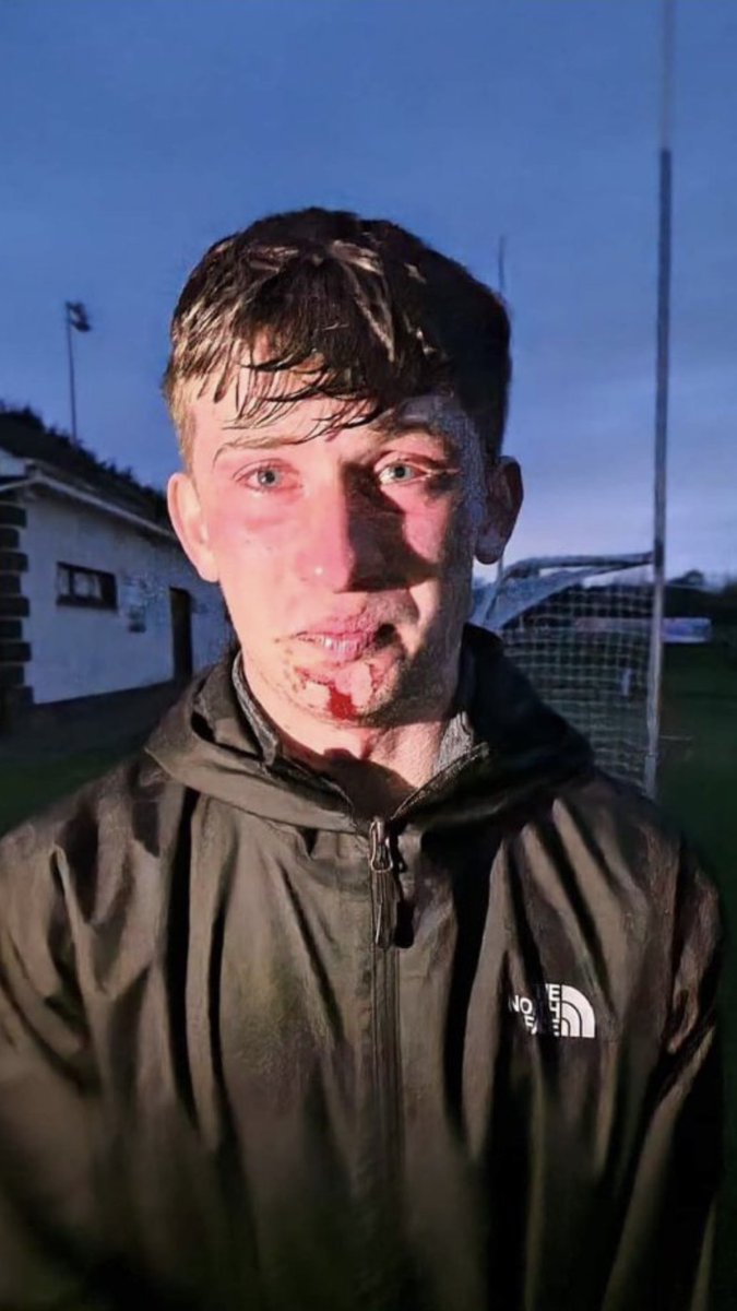 This boys face has haunted me since last night  ..how fucking dare you #GardaScum do this to a child of Eire .. 
Enough is Enough 
##stoptheplantation 
#IrelandisFull