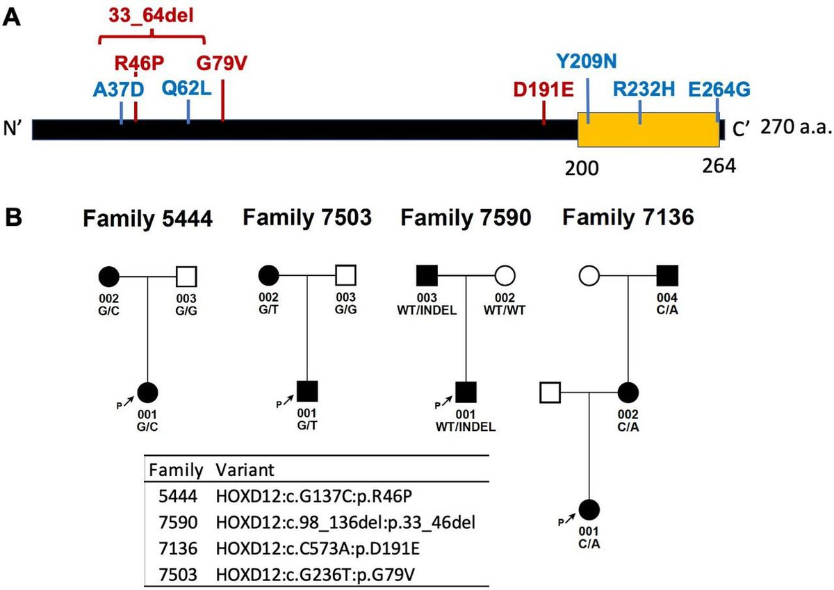 Exome sequencing of 1190 non-syndromic clubfoot cases reveals HOXD12 as a novel disease gene. #morbidgene #RareDisease #Genetics jmg.bmj.com/content/early/…