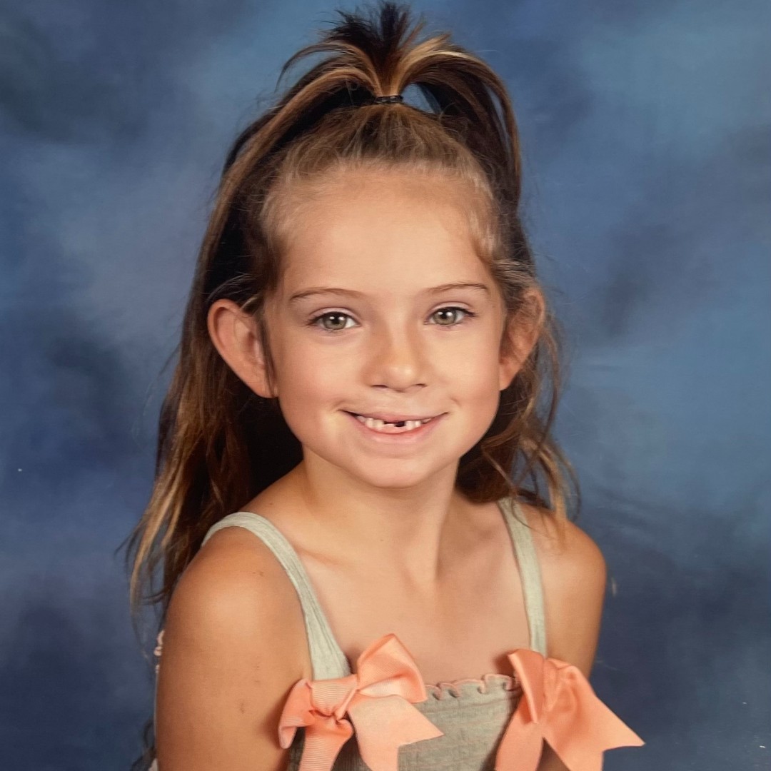 Happy early birthday 7th birthday to Rosalie!
This cutie makes the trek to Ohio with her family to see Dr. Scott Rapp for cleft lip and palate treatment. You have a beautiful smile, Rosalie! A cleft diagnosis can be scary, but our experienced team can help.
#CleftLip #CleftPalate