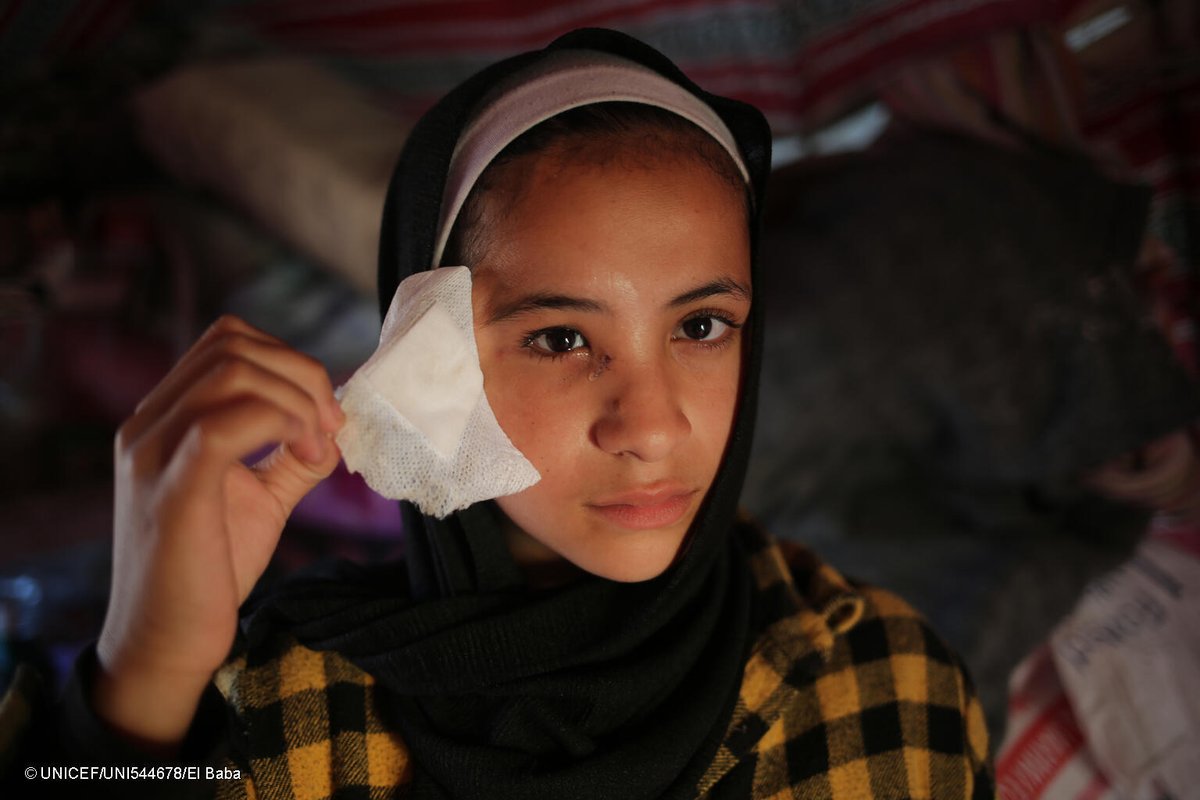 “When my house was bombed and destroyed, two of my brothers were killed, and a third one was injured. Some shrapnel hit my right eye, causing weak eyesight and constant tears.” 15-year-old Abrar in Gaza. In wars, children always pay the highest price. They need a ceasefire now.