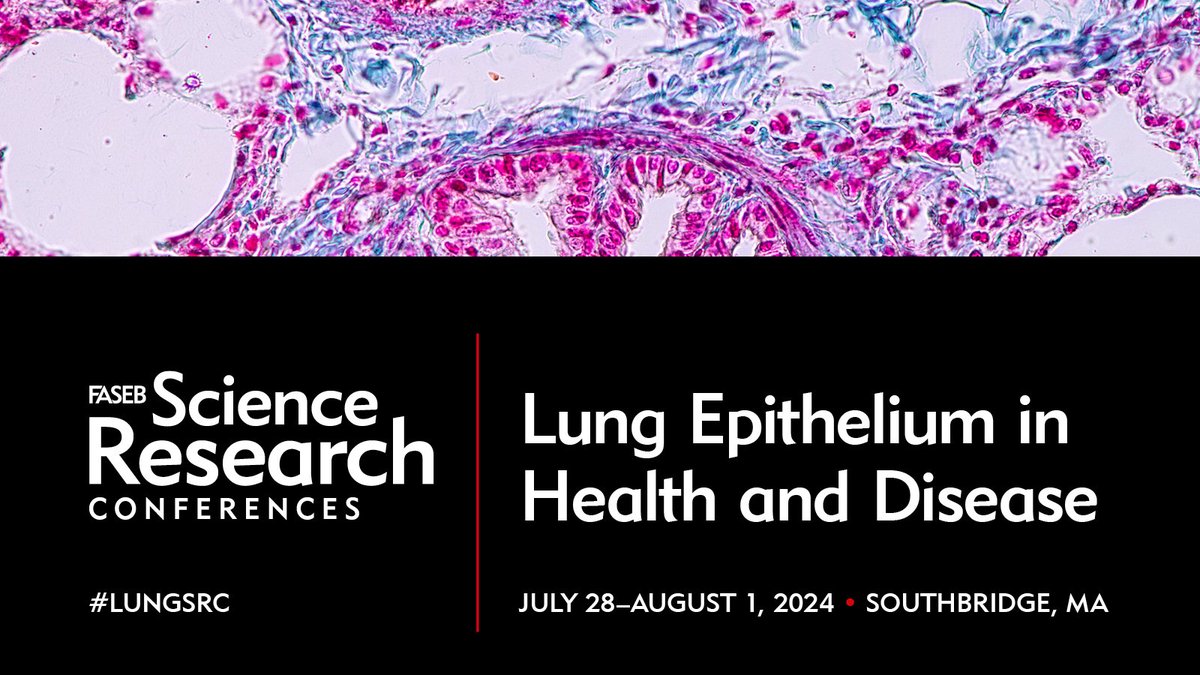 #LUNGSRC has been the premier meeting for studying lung diseases for over 20 years. Organizers including @sucre_jen and @JKropski have put together an amazing program featuring keynote speaker @JswLab and more. View the full program and save your space: hubs.ly/Q02v8yGf0