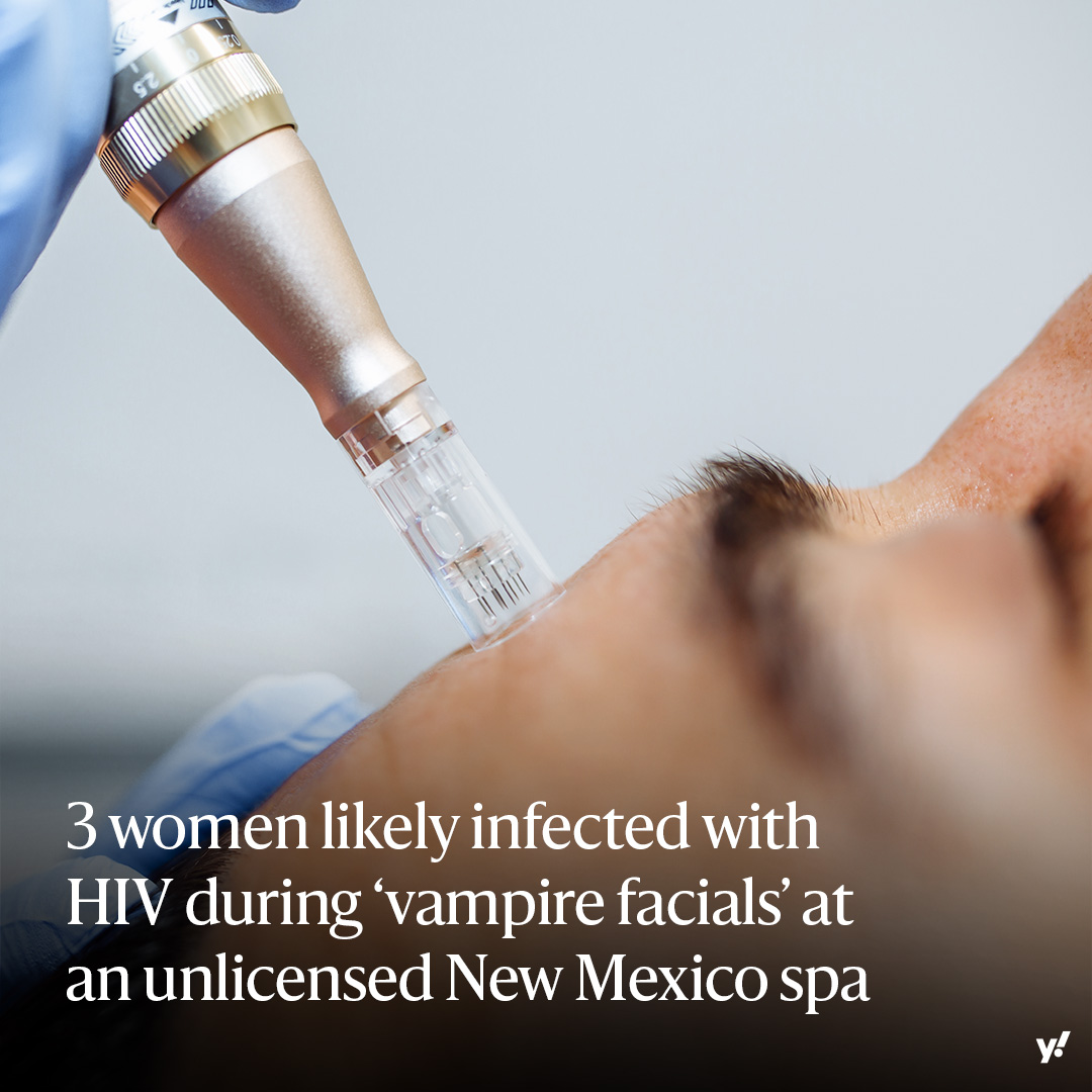 The CDC said Thursday that this marks the first known HIV cases transmitted via cosmetic injections. Officials disclosed that the Albuquerque spa did not have appropriate licenses to operate and was not using proper safety measures. yhoo.it/44k2tuP