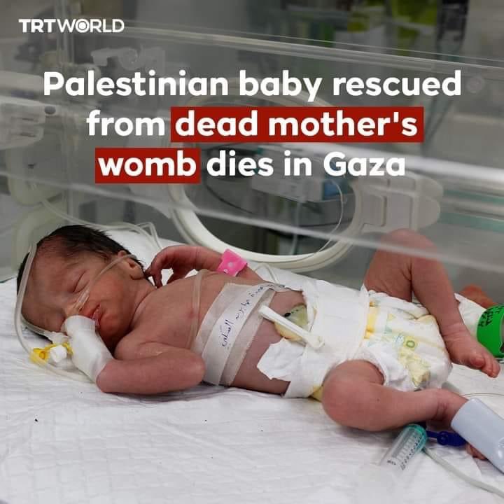 Sabreen Jouda,a Palestinian infant pulled alive from dead mother's womb shortly after the woman was killed in an Israeli air strike,died in a Gaza hospital onApril 25 after her health deteriorated
until when will this murderous silence towards Zionist crimes? 
#IsraelIsATerrorist
