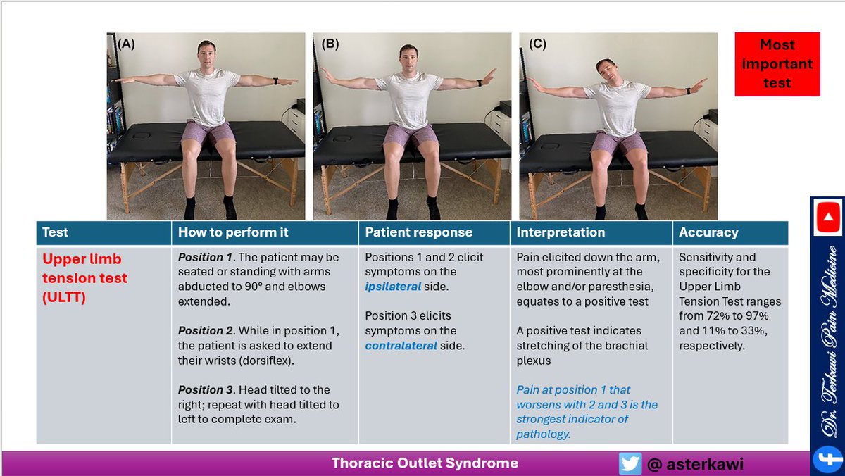 Just published, must watch! Comprehensive review on Thoracic Outlet Syndrome (TOS): youtu.be/ywMmjYXwTMY #thoracicoutletsyndrome #Neckpain #Shoulderpain #brachialplexus #painphysician