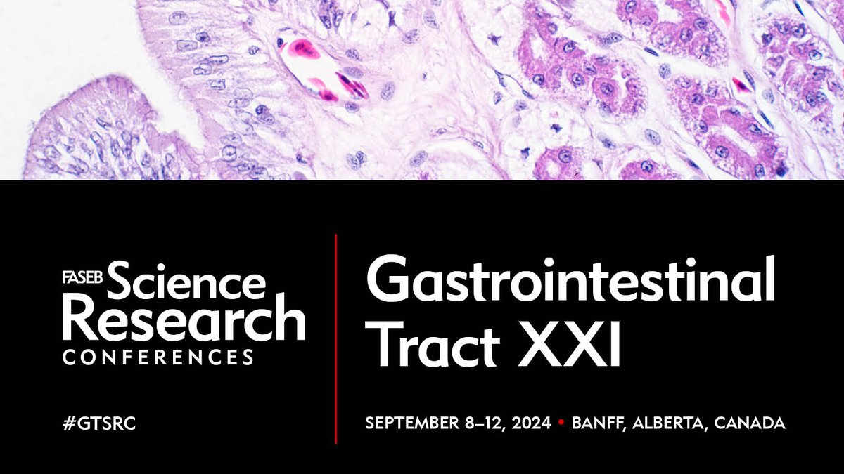 You've got 3 months until the #GTSRC24 abstract deadline on 7/14! We have exciting speakers across all areas of #GIresearch including: #stemcells, #microbiome, #mucosalimmunology, #cancer, and #epithelialbiology. Registration is open, secure your spot now! bit.ly/4aGQjiC