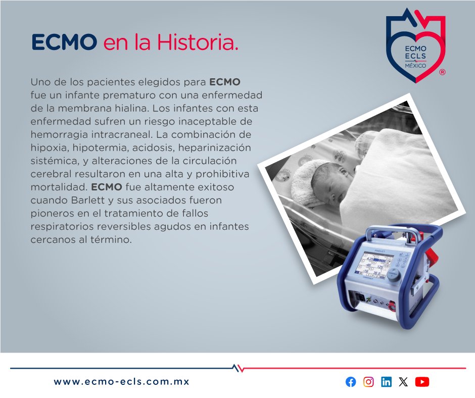 #ConocimientoECMO
ECMO EN LA HISTORIA.
Fuente: nicklauschildrens.org
#ECMO_ECLS_México #SalvandoVidas #TerapiaECMO #Chihuahua #Gdl #CDMX
#AtenciónECMO
Urgencias, atención y traslados 24/7
☎ GDL 33 2332 6342
☎ CDMX 55 7662 3520
☎ Chihuahua 61 4529 7585