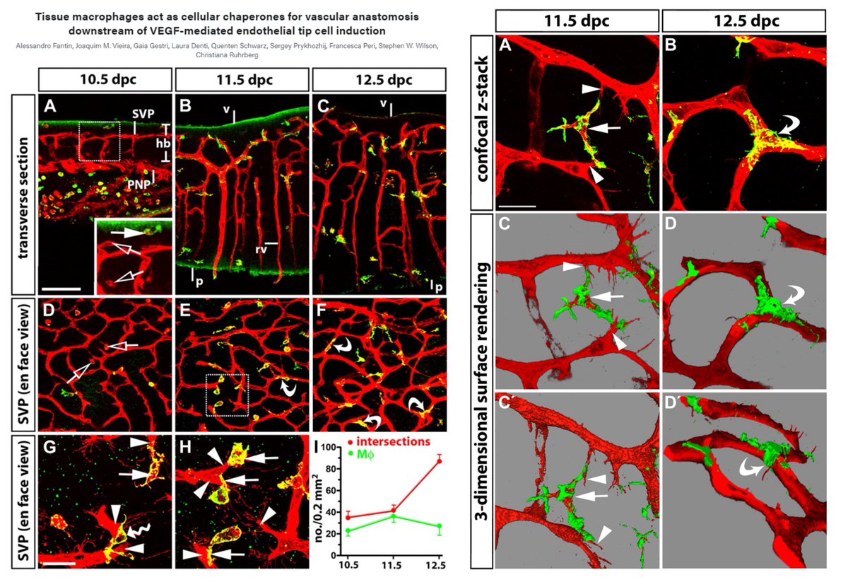 Hao Yin (@haoyin20) on Twitter photo Landmark revisit
Tissue macrophages act as cellular chaperones for vascular anastomosis downstream of VEGF-mediated endothelial tip cell induction
Macrophages pull together angiogenic sprouts to fuse!😍
<a href="/Joey_JMVieira/">Joaquim Miguel Vieira</a> <a href="/RuhrbergLab/">Ruhrberg lab</a> <a href="/BloodJournal/">Blood Journal</a> 2010
ashpublications.org/blood/article/… Landmark revisit
Tissue macrophages act as cellular chaperones for vascular anastomosis downstream of VEGF-mediated endothelial tip cell induction
Macrophages pull together angiogenic sprouts to fuse!😍
<a href="/Joey_JMVieira/">Joaquim Miguel Vieira</a> <a href="/RuhrbergLab/">Ruhrberg lab</a> <a href="/BloodJournal/">Blood Journal</a> 2010
ashpublications.org/blood/article/…