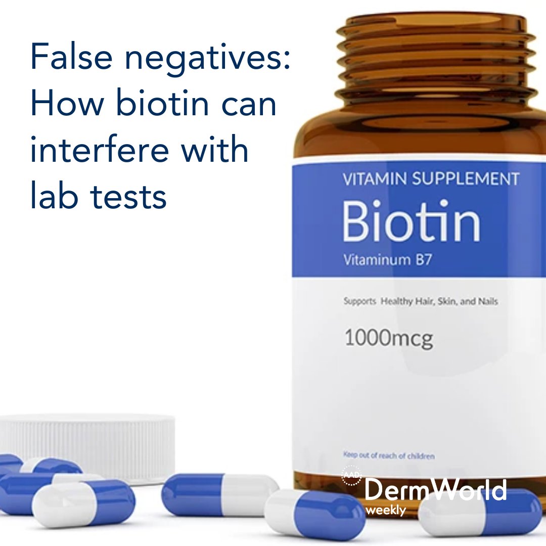 AADmember's tweet photo. In a @JAADJournals Letter to the Editor, Dirk Elston, MD, FAAD, discusses the various ways in which high-dose #biotin supplementation may interfere with lab testing. Learn more in #DermWorldWeekly. https://t.co/YE8GafCfVZ https://t.co/DMLn0awGnO