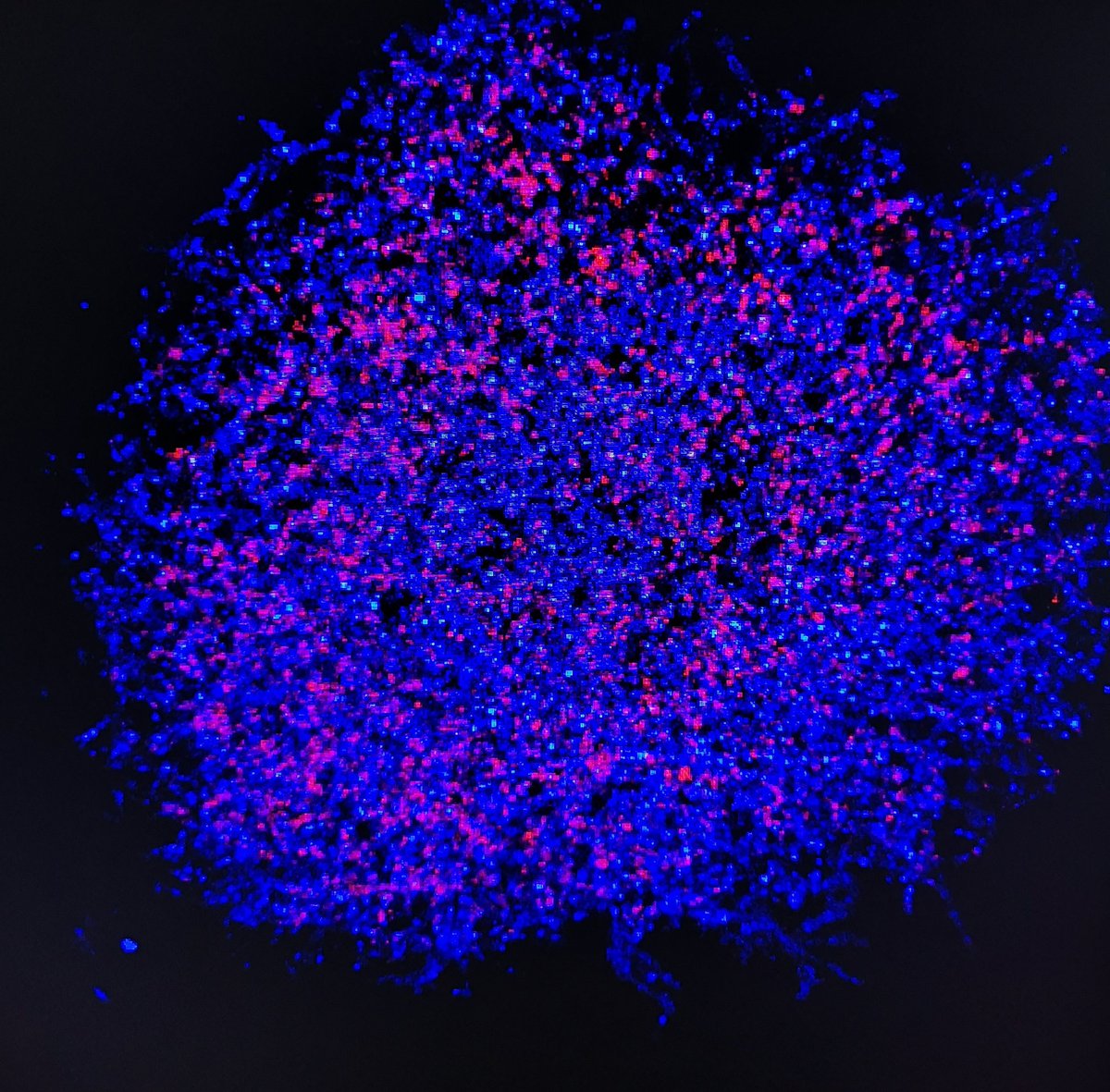 Day 90 Retinal #organoids stained for apoptosis marker (caspase 3 shown in red)
#FluorescenceFriday #visionresearch #stemcells #sciart