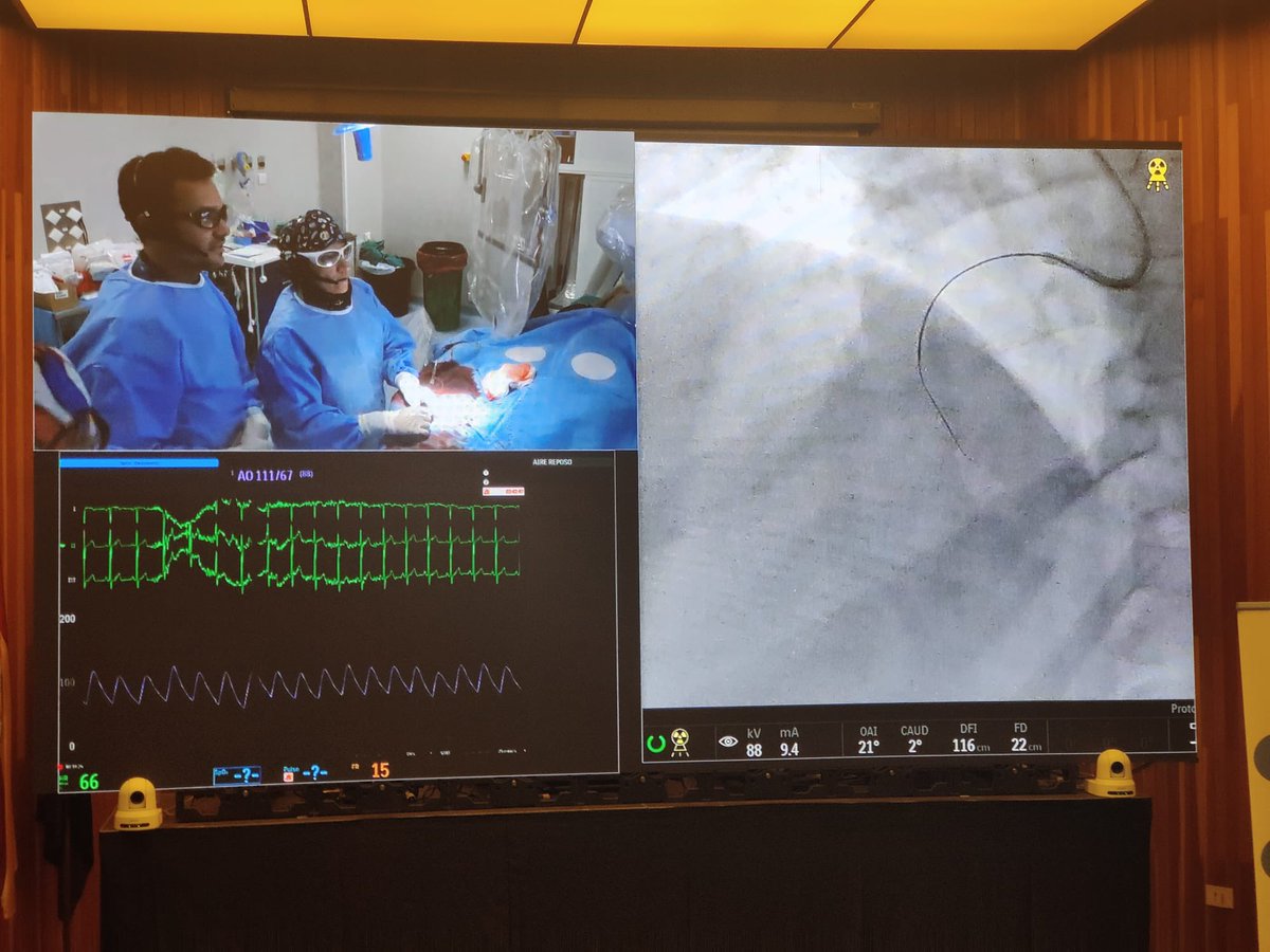 Reunión Anual de uso de DCB en HJRJ. Huelva. Dos Jornadas, rodeado de expertos buscando la excelencia en el uso de DCB. Gracias al HJRJ, a todos los amigos que nos habéis ayudado a hacerlo realidad y a EPIC, BBRAUN por su excelente organización <a href="/fundacionepic/">Fundación EPIC</a> <a href="/pemarlor08/">Pedro Martín Lorenzo</a> <a href="/MPAOSS/">Manuel Pan</a>