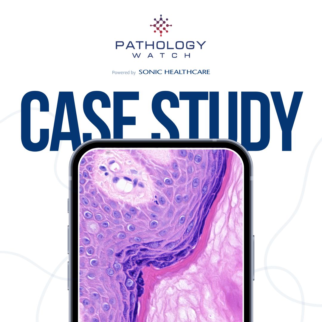 “A picture’s worth a thousand words. You can explain all of the science in the world, but when a patient sees a digital slide, they know it.” Jesse Jensen, DO, West Valley Read the full case study: brnw.ch/21wJdXI #Pathology #Dermatology #Skin #MedTech #MedTechnology