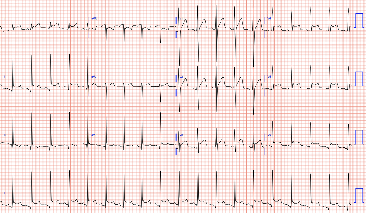 Jeffrey M Vinocur tweet media