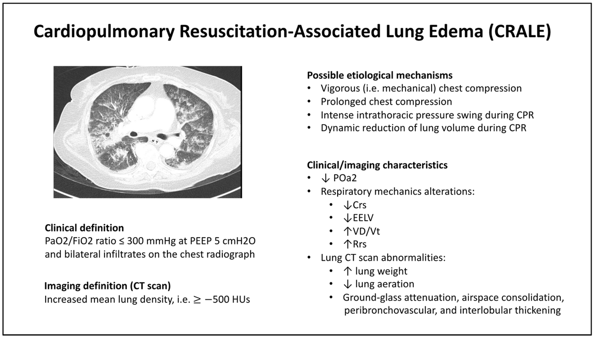 Acute Lung Injury after Cardiopulmonary Resuscitation CCR Journal Watch criticalcarereviews.com/latest-evidenc… Get the latest critical care literature every weekend via the CCR Newsletter - subscribe at criticalcarereviews.com/newsletters/su…
