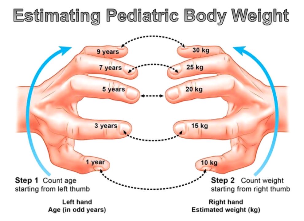 Estimating pediatric body weight @jackcfchong