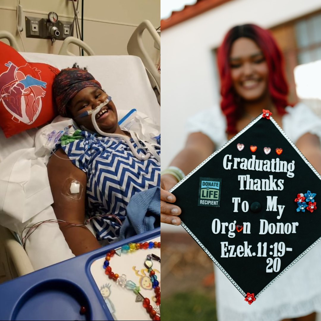 Jack was a toddler with failing kidneys. Lanayah was a 13-yr-old 🏀 player with dilated cardiomyopathy. Thanks to generous donors, we were able to help them with #OrganTransplants and now they are both thriving! We ♥️ our courageous #Transplant patients!