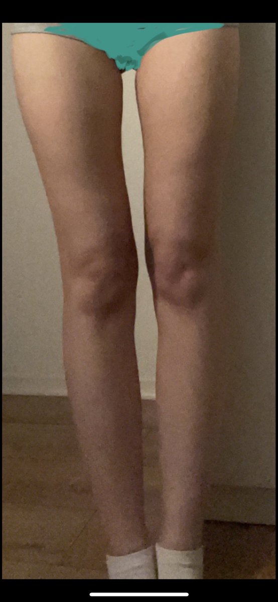 Guys which one my legs are? I feel like 4 and i don’t know if I’m right or it’s just bodydysmorphia 😭