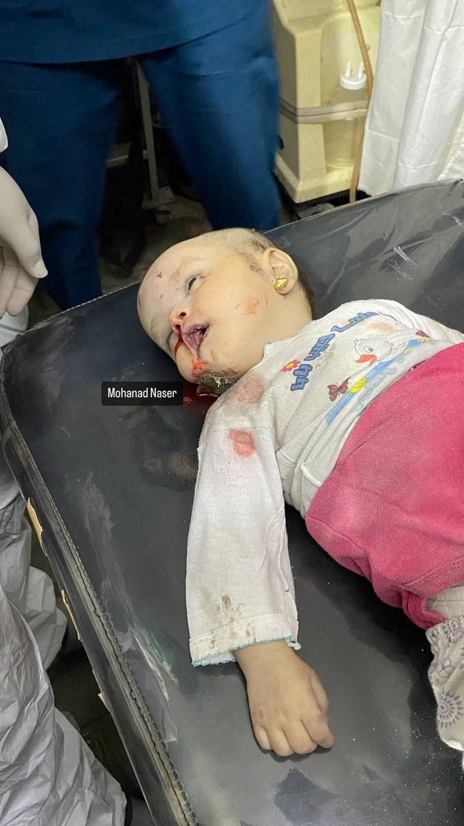 Gazze... V@mpir israil bebek kanına doymuyor! Bu geceki minik Şehidimiz... Kısa bir süre önce soykırımcı İsrail'in Refah'ın batısındaki evinde öldürülmesinin ardından güzelliği ve masumiyetiyle hayata gözlerini yumdu #SONDAKİKA #IsraeliTerrorists Katil Netanyahu İsrail…