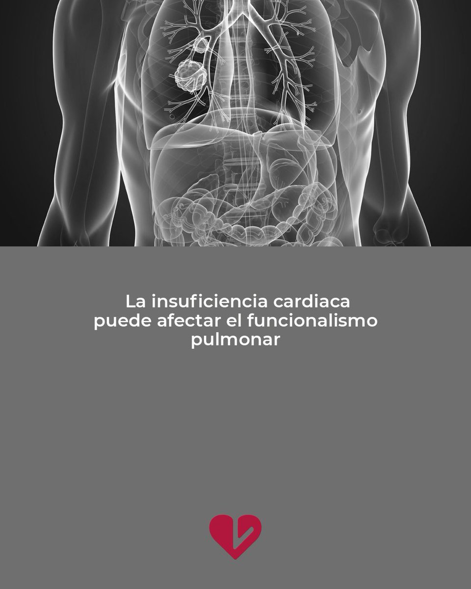 CardiologiaSVC tweet picture