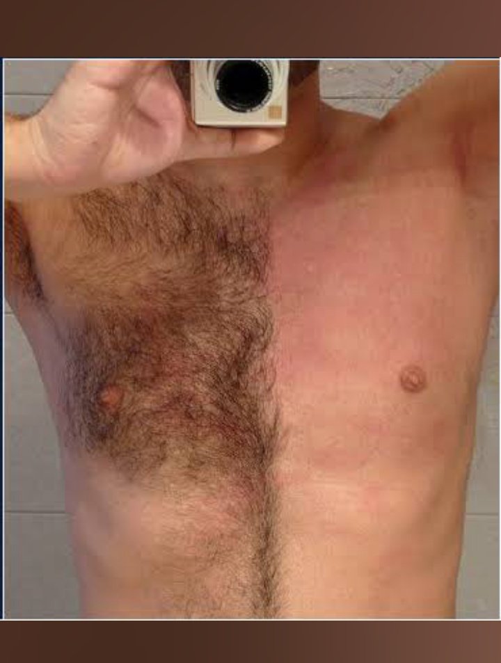 gerardoegrosso's tweet photo. Depilación masculina sistema español con cera y con bandas descartables. 
Respeto aún los PRECIOS JUSTOS.
Atiendo en mi gabinete climatizado en Av Entre rios entre Chile y Mexico de lunes a viernes de 8 a 22 HS.
Atendido por su propio dueño.
Brindate luego un masaje ERÓTICO. https://t.co/E4GlThLbiK