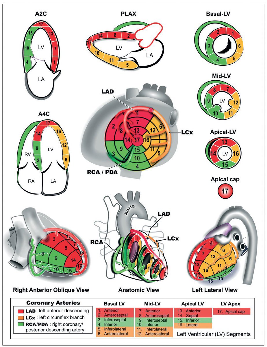 Echocardiogram Anatomy. ECG Lecture: lnkd.in/gVN8gqPE