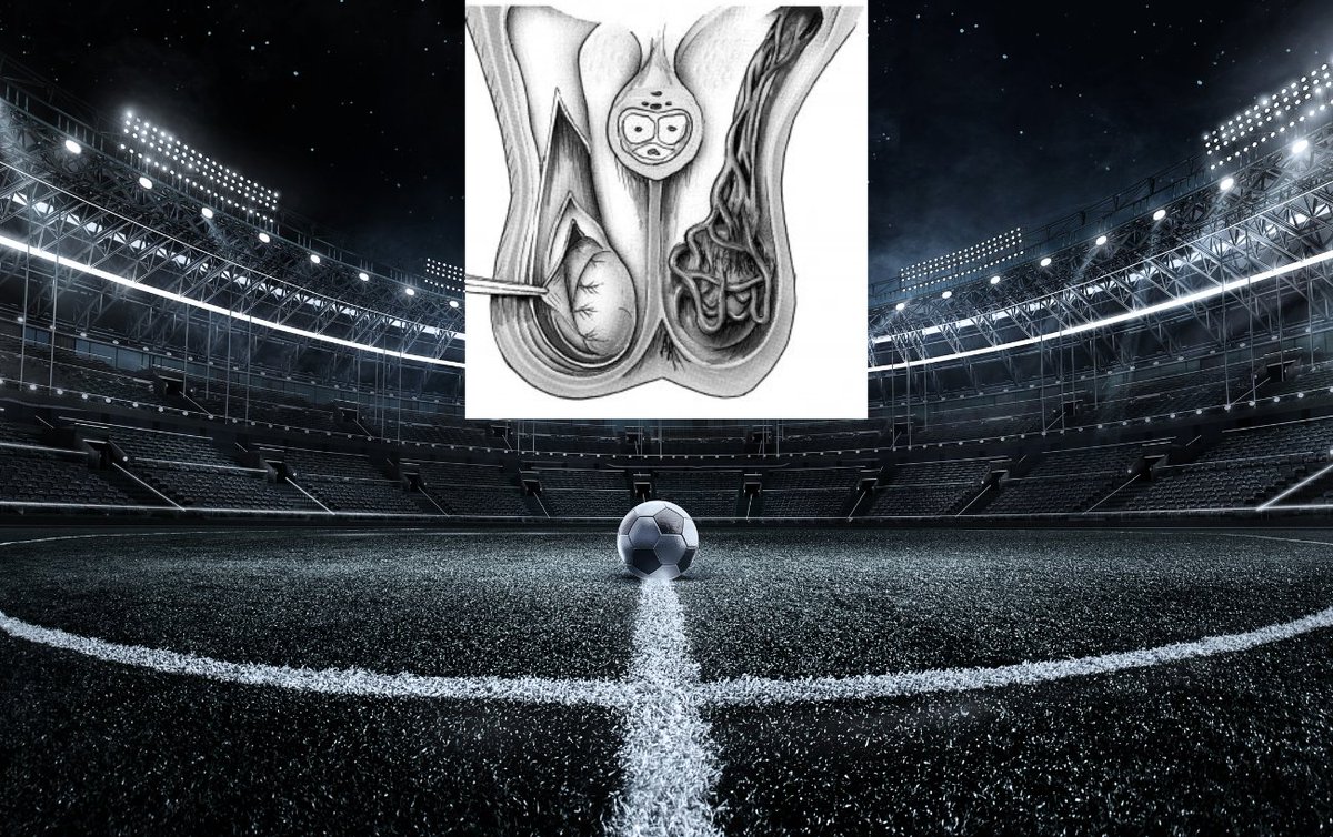 #Soccer cause #testicularpain? START NOW!