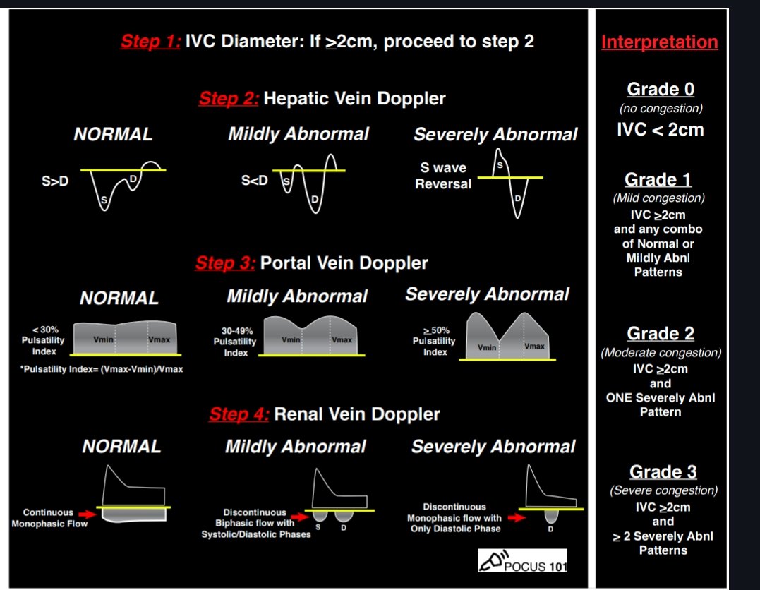 ⚡ Normal waves in VEXUS * S>D wave in hepatic vein * <30% variation in PV * flat negative venous wave in renal vein ⚡ Use IVC distensibility index in ventilated patients ⚡VTI change > 12% with fluid or leg raising is sign of fluid responsiveness #ISOTMIDTERM