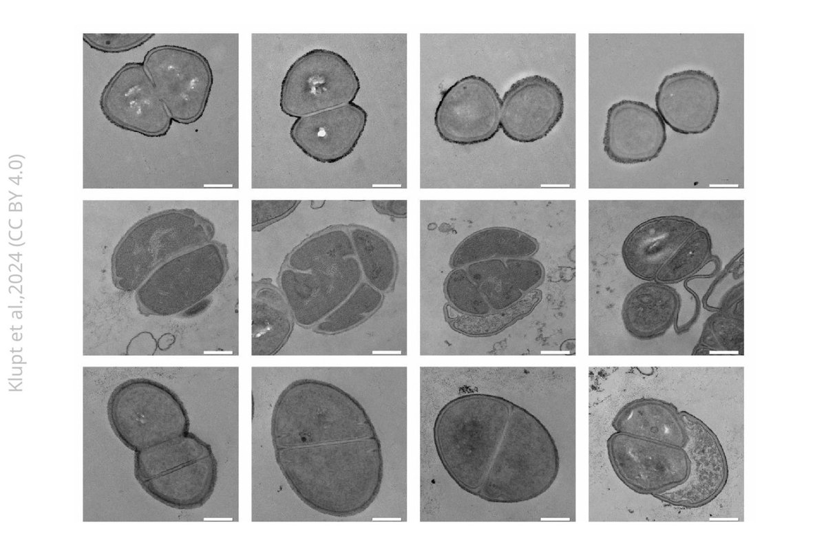 An enzyme that remodels the cell wall of the gut bacterium E. faecium helps them enhance the immune response against cancer. elifesciences.org/articles/97277…