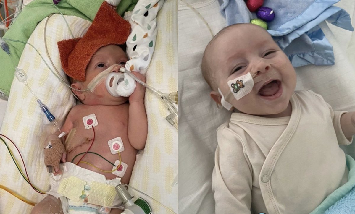 Update: South African Community Unites to Bring Baby Brayden Home - goodthingsguy.com/people/update-…