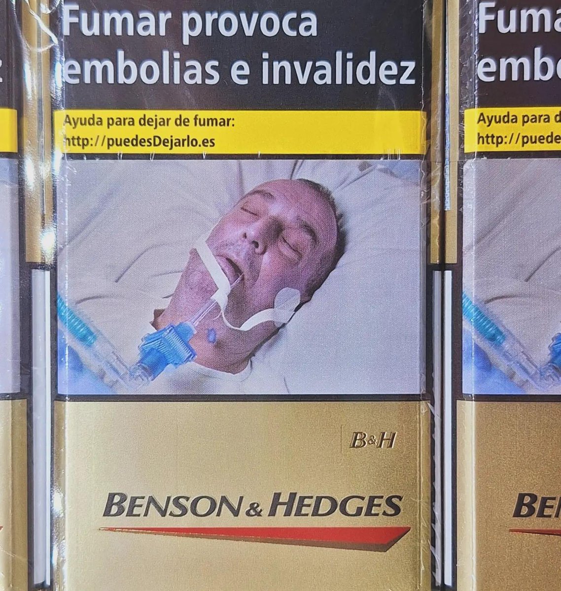 Has Nigel Farage begun modelling for the health warning on these Benson & Hedges cigarettes?