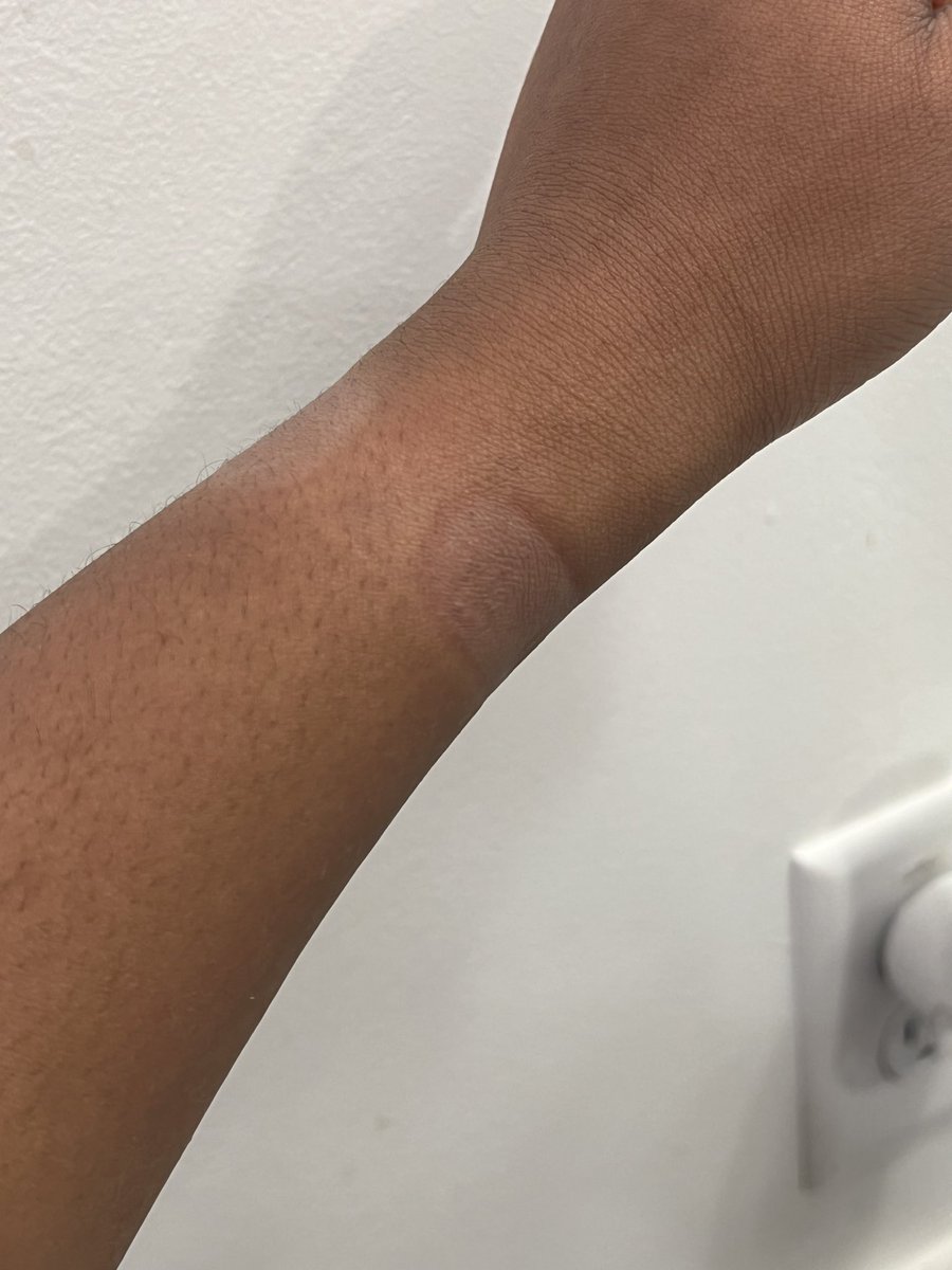 “Do you wear your Apple Watch often?” … My wrist—