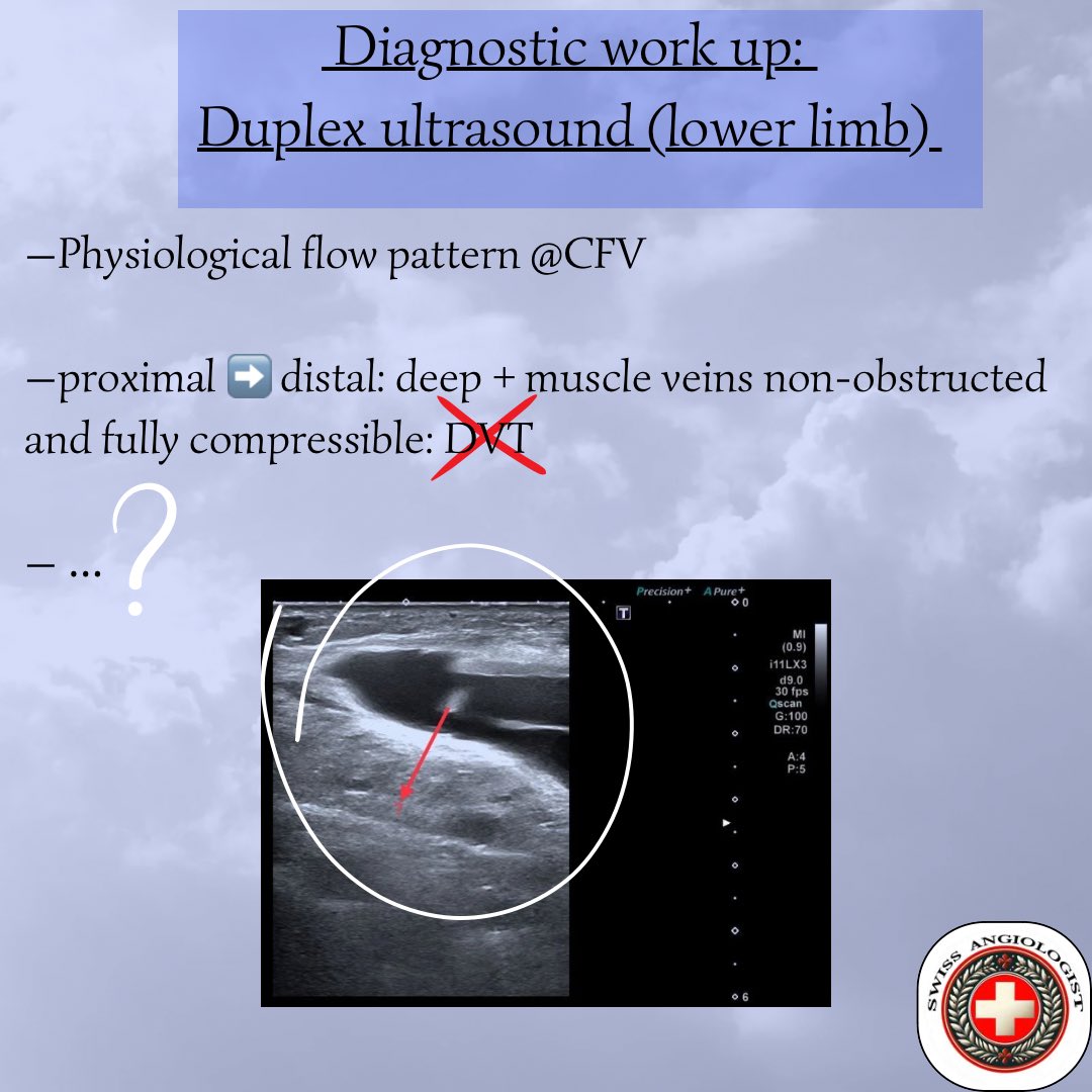 AngioUpdates's tweet photo. Paravascular Sonographic Findings 1/2
Test yourself!
What did you spot in the images?
#paravascularimaging
#duplex
#flowpatterns https://t.co/XiZzTaHEyp