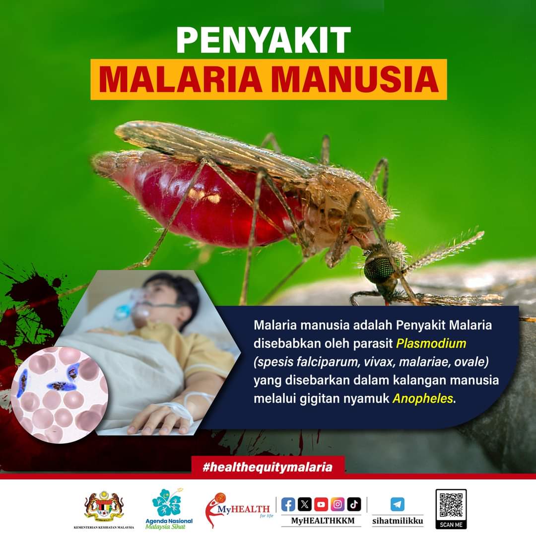 Malaria manusia adalah penyakit Malaria disebabkan oleh parasit Plasmodium yang disebarkan dalam kalangan manusia melalui gigitan nyamuk Anopheles.

#ANMS #healthequitymalaria #sihatmilikku