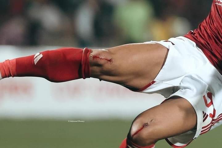 أصابتين في الركبة ولكن كمل وأتحمل وسام أبو علي مقاتل الأهلي الجديد 🧿❤️