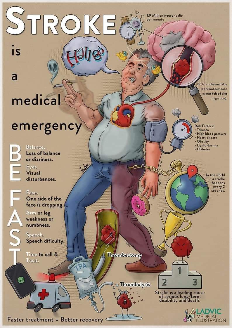 Remember, a #stroke is ALWAYS a medical emergency. The longer a stroke remains untreated, the greater the chance of stroke-related brain damage. If you or someone around you begins to experience these symptoms, call 999 or 112 immediately.