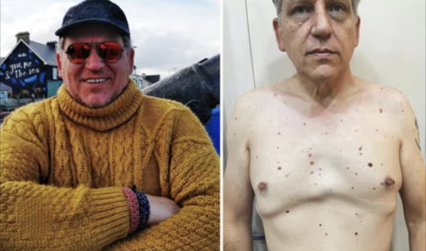 He's lost more than half his body weight. Lost teeth. Fought one infection after another. He has a life threatening skin condition & has a history of melanoma. 
He is always in pain. 
1116 days imprisoned in Iraq 
#freerobertpether #nelsonmandelarule #HRW