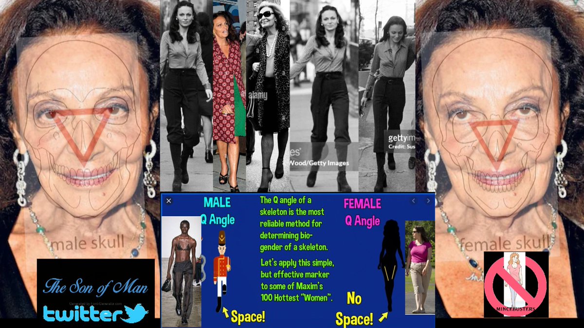 Diane von Furstenberg fails the Forensic tests/Bio male skull/ 5x the MALE gait/straight legs/knees together/feet forwards/with a SPACE/but Fanx for playing CSi with me #forensics #CSI #EGI                                                 
 ~ Its ALL of them ..No Exceptions