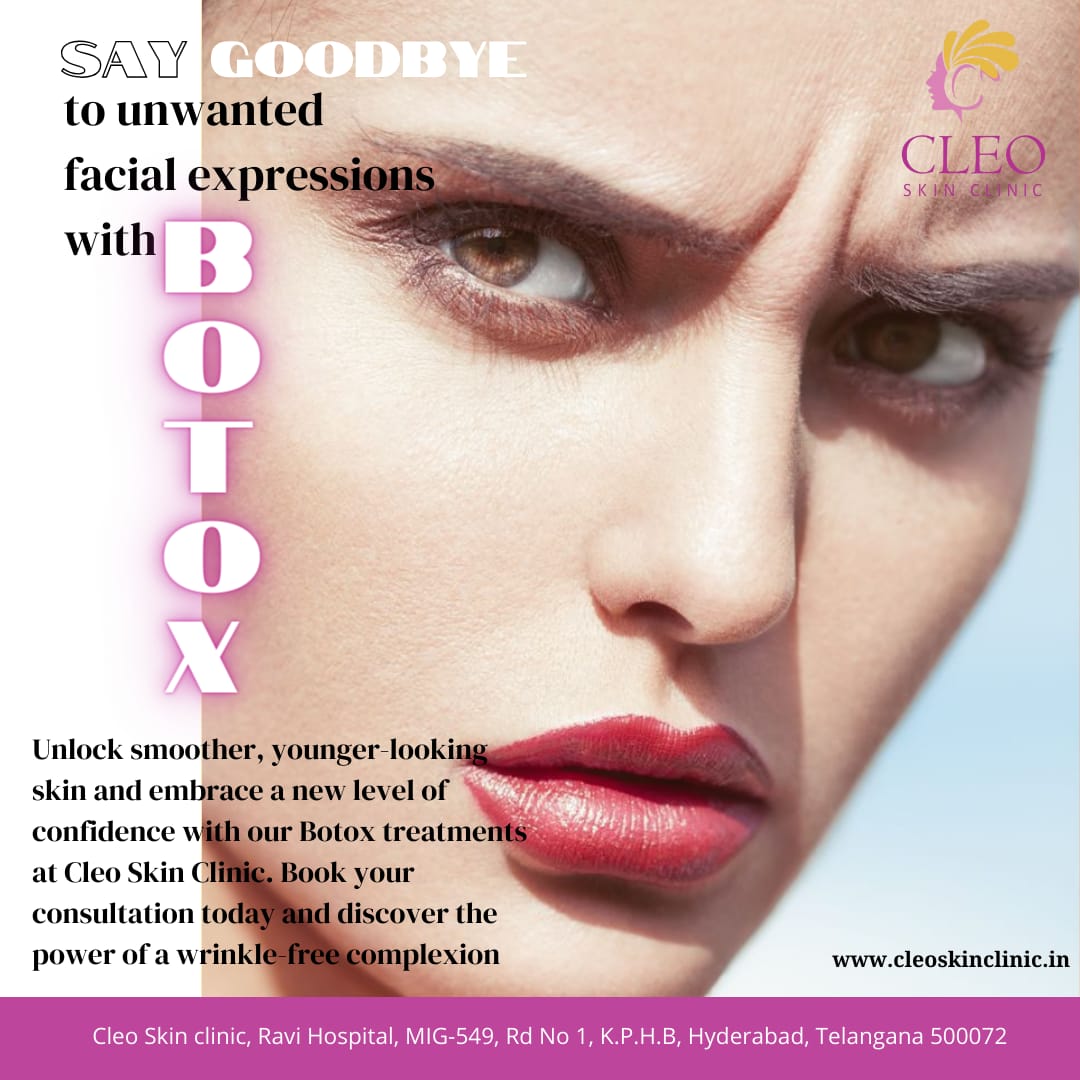 Embrace a wrinkle-free future with our transformative Botox treatments!
#Botox #WrinkleFree #YouthfulSkin #ConfidenceBoost #CleoSkinClinic #BeautyTreatment #SmoothSkin #FacialExpressions #AgeDefying #WrinkleReduction #BotoxTreatment #YouthfulComplexion #NewConfidence