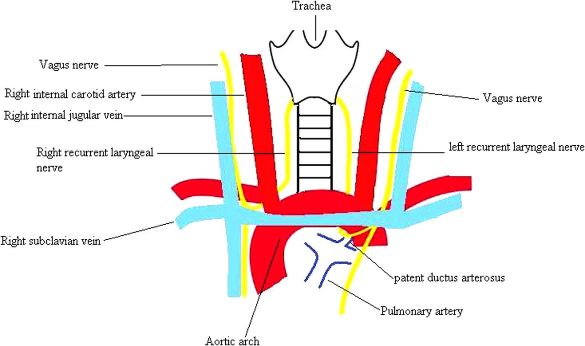 @DustyDevil19 Recurrent laryngeal nerve, the vagus nerve going down and under major blood vessels before u-turning because we missed the larynx, darn it. Planning fail right there.