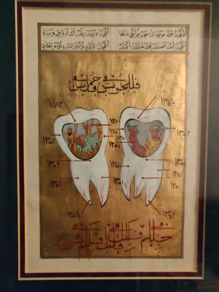 Ottoman dental book showing a tooth infection