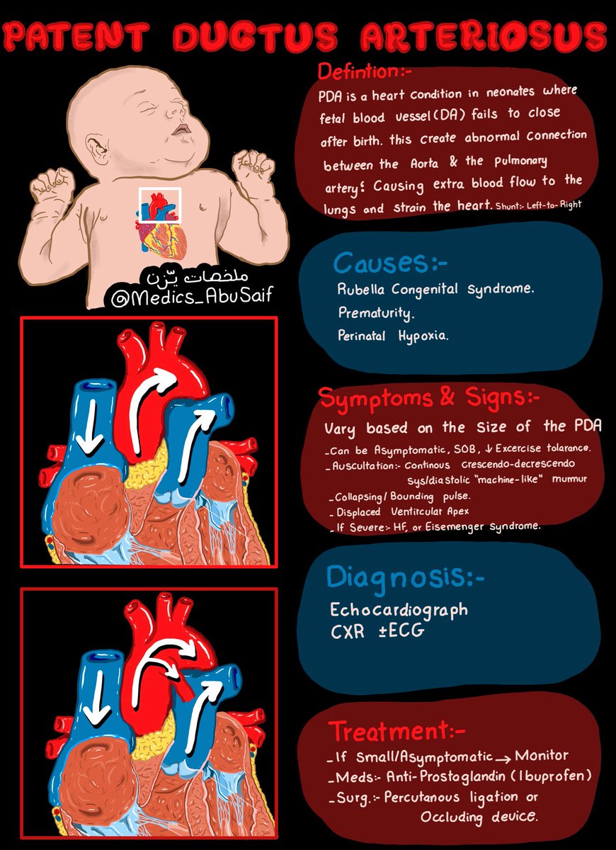 ملخص بسيط عن PDA 🫀