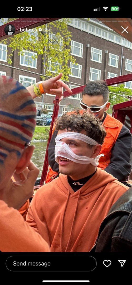 stxphology's tweet image. lando partied so hard he landed with a bloody nose but at least he&apos;s happy and having fun