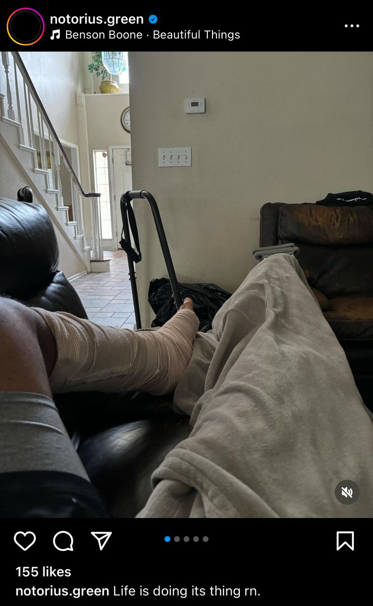 #OKState running back AJ green posts on his Instagram his foot in a cast. Likely sidelined for a while.