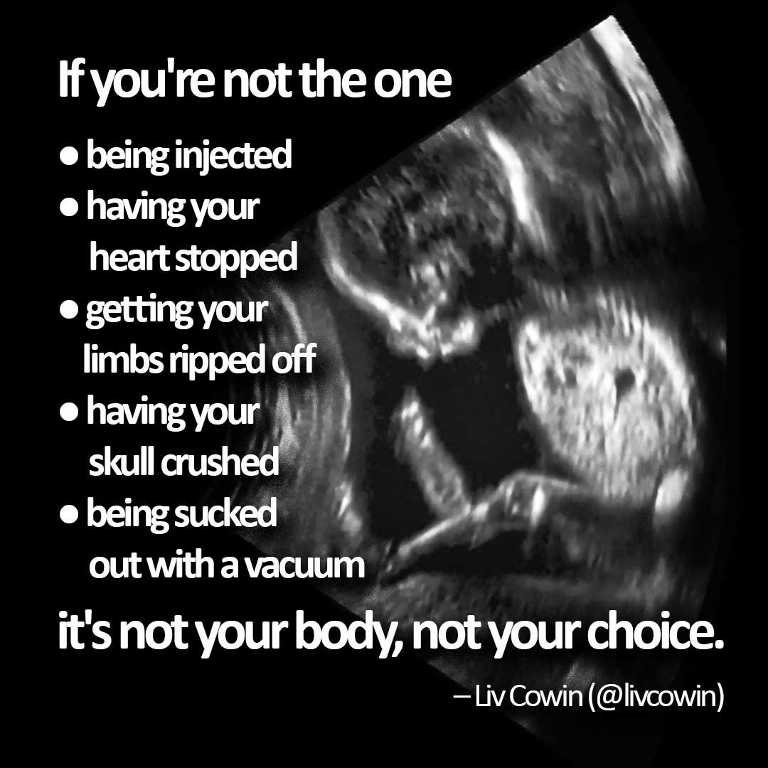 @Ally_Sammarco Yes, you’re absolutely right.  And babies shouldn’t be slaughtered in the womb either, or are they less important to you than a dog?