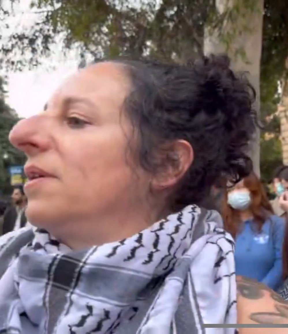 'Jewish noses are so big and ugly', says woman with a literal beak