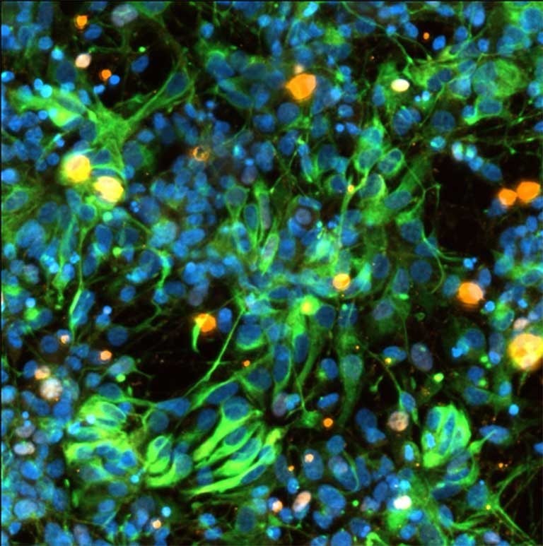 Every 6 minutes, someone is diagnosed with #Parkinsonsdisease. Last month, #research from the @nationalscf launched to the @Space_Station aiming to benefit millions worldwide. #ParkinsonsAwarenessMonth
Details: ow.ly/I8z150RlpFY