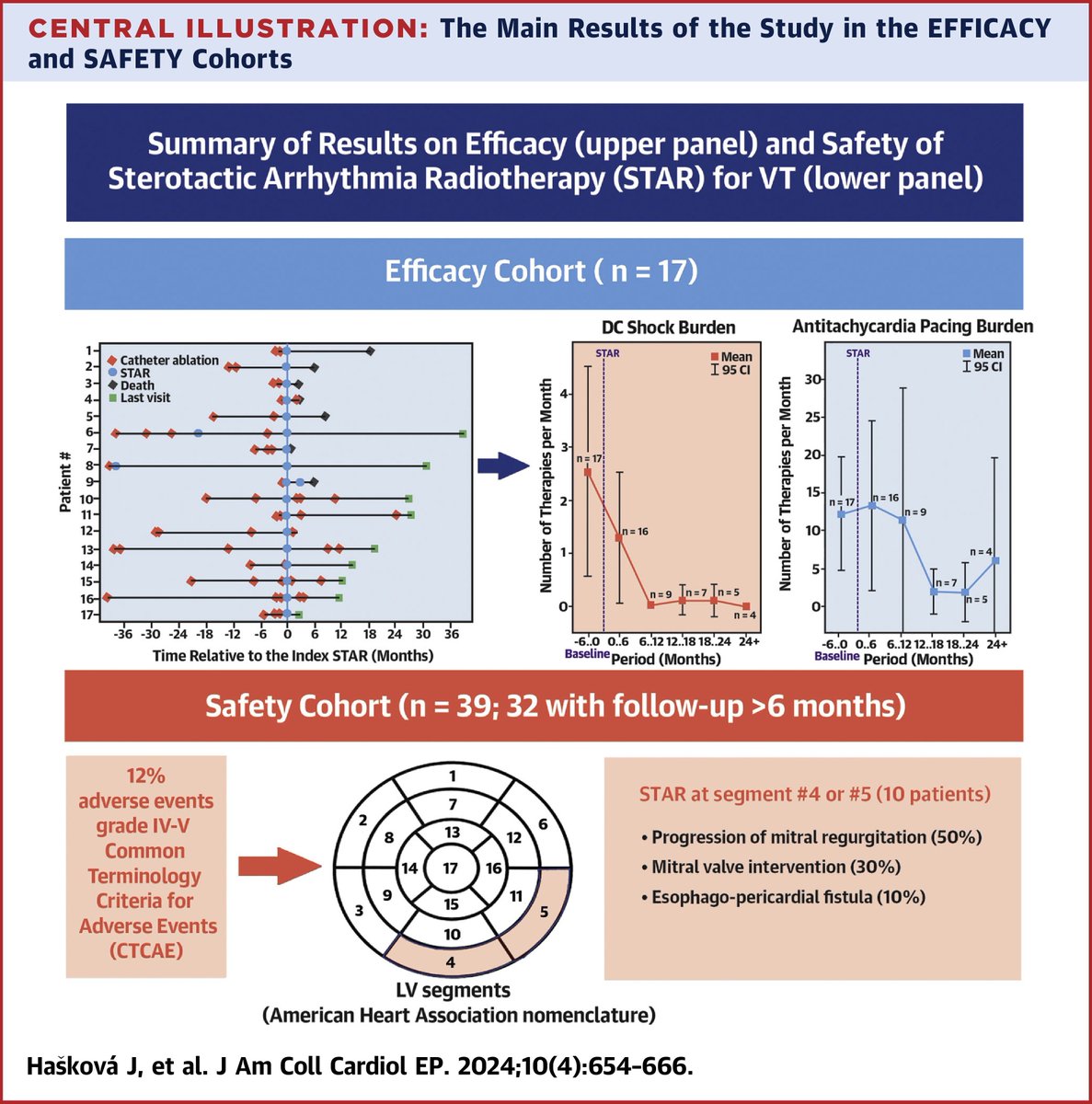 🧵Data from Czech Republic on Stereotactic Radiotherapy (STAR) for recurrent VT. 

👉Although STAR may not be very effective in preventing VT recurrences, it can still modify arrhythmogenic substrate, and when used with additional ablation, reduce number of ICD shocks.