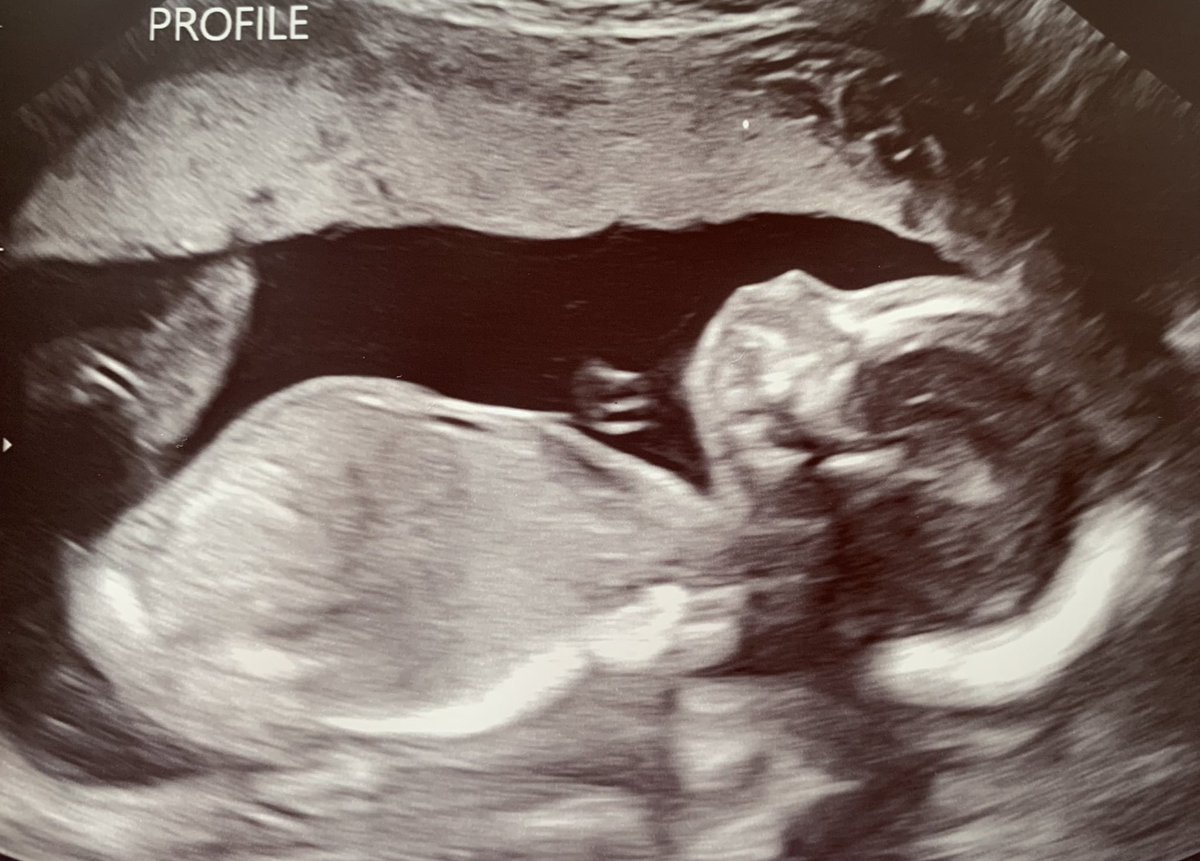 Hal the Hot Dog Guy tweet media