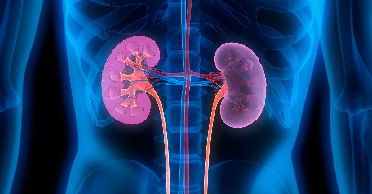 Curious about the effects of supplements on your kidneys? Read our guide to find out how supplements can affect your renal organs. wb.md/3Wmie2m