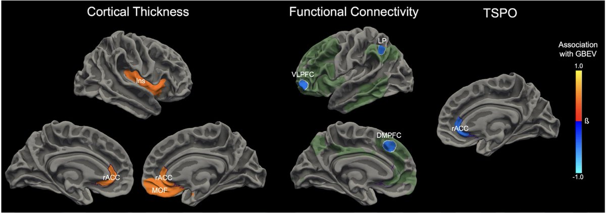 Neuroimaging, blood proteomics, and health data from 30 military personnel show that increased exposure to explosive blasts was associated with structural and functional brain alterations and a decrease in health-related quality of life. In PNAS: ow.ly/bfNA50RpWfO