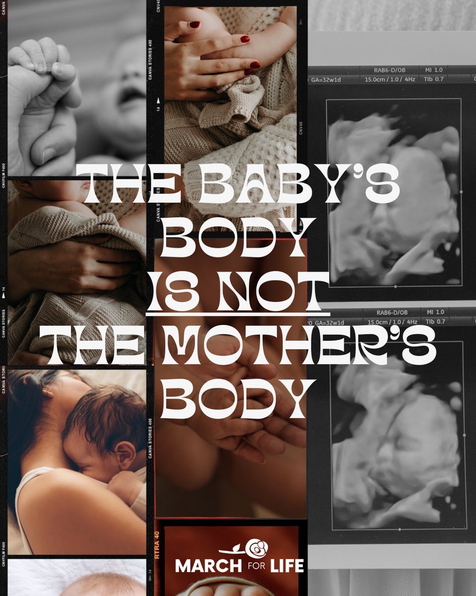 March_for_Life's tweet photo. Each person has their own entire genetic code and distinct body from the moment of conception.

Therefore, if it’s not your body, it’s not your choice. https://t.co/pjHU9UEx5B
